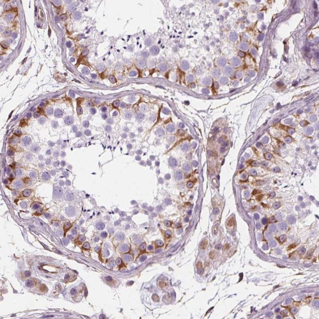 PGAP1 Antibody in Immunohistochemistry (Paraffin) (IHC (P))