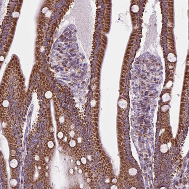 PYCRL Antibody in Immunohistochemistry (Paraffin) (IHC (P))