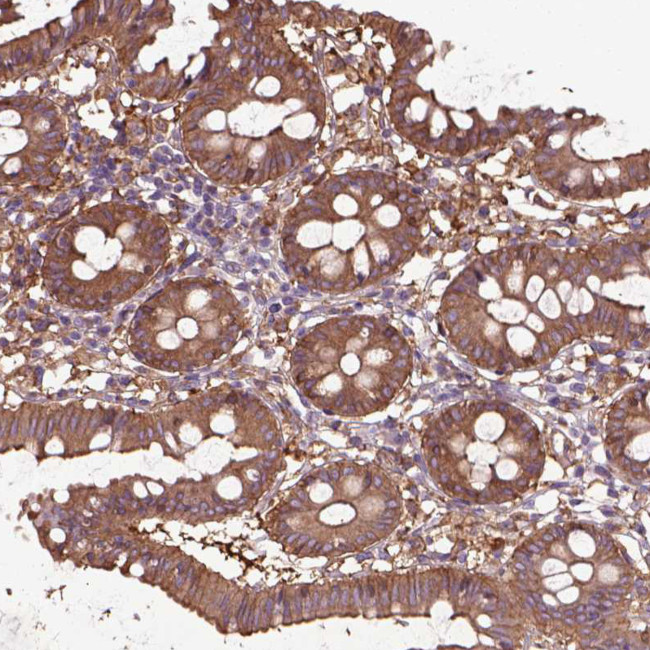 Coronin 1B Antibody in Immunohistochemistry (Paraffin) (IHC (P))