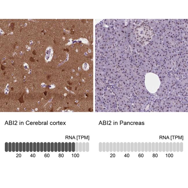 ABI2 Antibody in Immunohistochemistry (IHC)