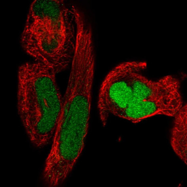 SMC2 Antibody in Immunocytochemistry (ICC/IF)