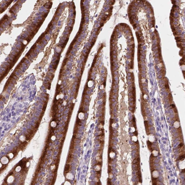 NOXO1 Antibody in Immunohistochemistry (Paraffin) (IHC (P))