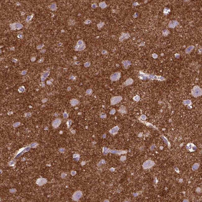 CSPG5 Antibody in Immunohistochemistry (Paraffin) (IHC (P))