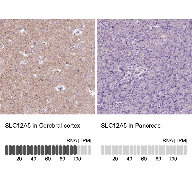 KCC2 Antibody in Immunohistochemistry (IHC)