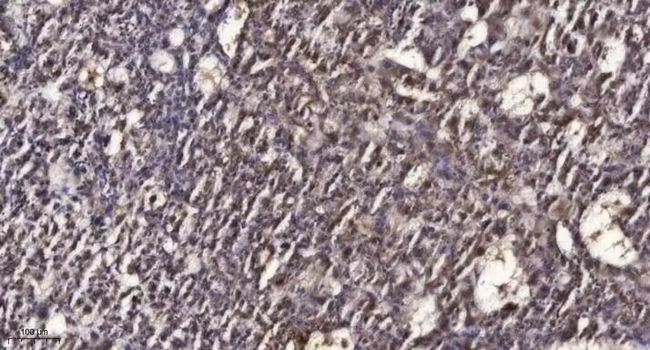 Phospho-RAD50 (Ser635) Antibody in Immunohistochemistry (Paraffin) (IHC (P))