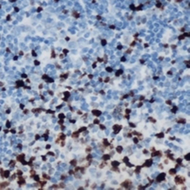 Phospho-ETS1 (Ser251) Antibody in Immunohistochemistry (Paraffin) (IHC (P))