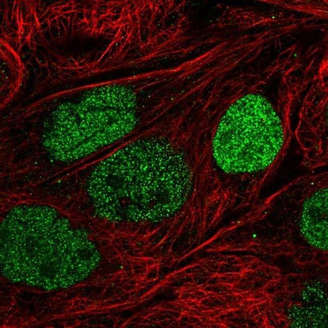 PSD3 Antibody in Immunocytochemistry (ICC/IF)