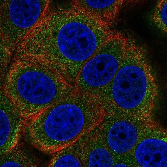 ALG12 Antibody in Immunocytochemistry (ICC/IF)