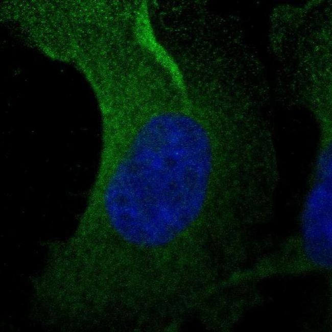 Asparagine Synthetase Antibody in Immunocytochemistry (ICC/IF)