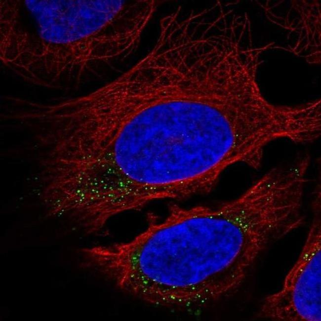 CNST Antibody in Immunocytochemistry (ICC/IF)