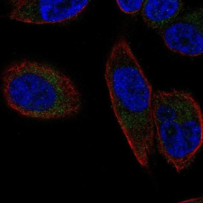 SLC25A23 Antibody in Immunocytochemistry (ICC/IF)