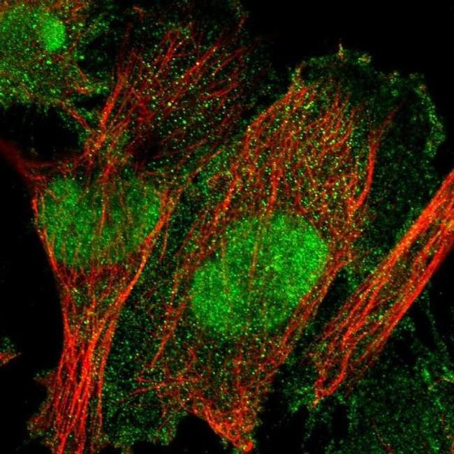 TULP3 Antibody in Immunocytochemistry (ICC/IF)