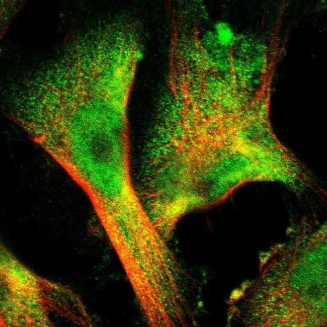 Sorcin Antibody in Immunocytochemistry (ICC/IF)