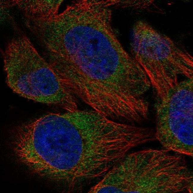 EDEM3 Antibody in Immunocytochemistry (ICC/IF)