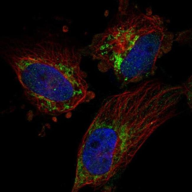 TFB2M Antibody in Immunocytochemistry (ICC/IF)