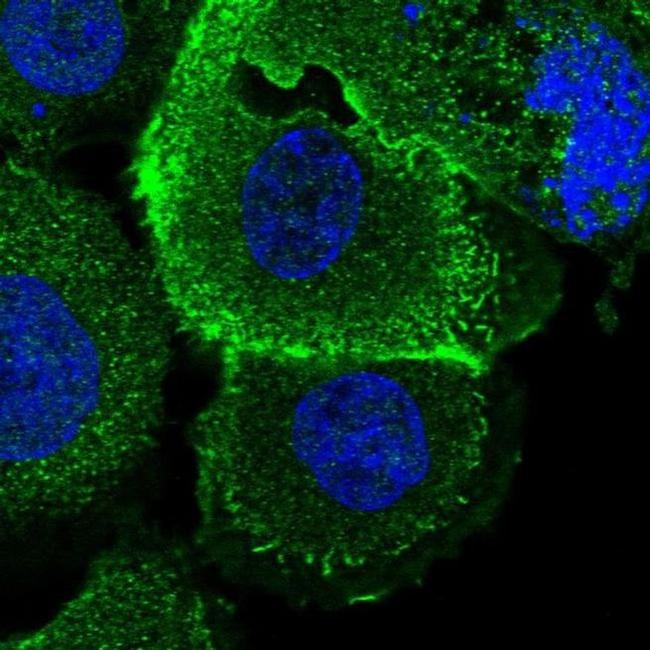 ROM1 Antibody in Immunocytochemistry (ICC/IF)