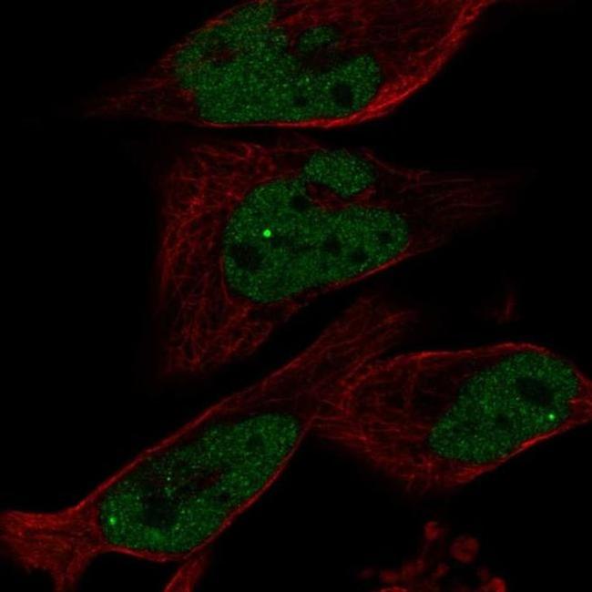 EYA1 Antibody in Immunocytochemistry (ICC/IF)