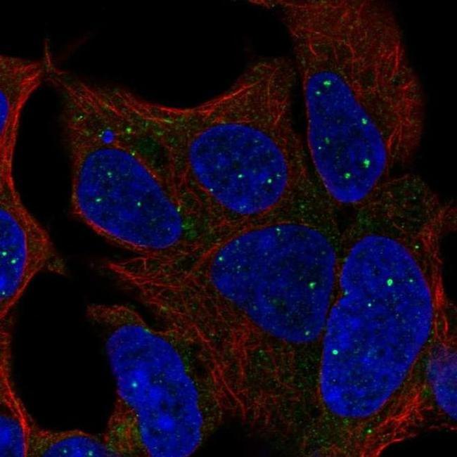 TBX1 Antibody in Immunocytochemistry (ICC/IF)