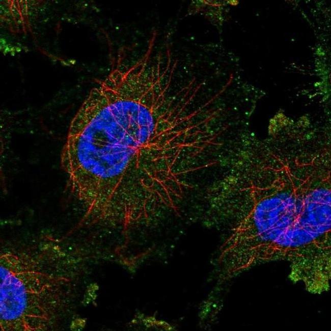 PIMT Antibody in Immunocytochemistry (ICC/IF)