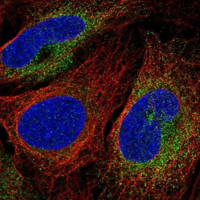 SCARA3 Antibody in Immunocytochemistry (ICC/IF)