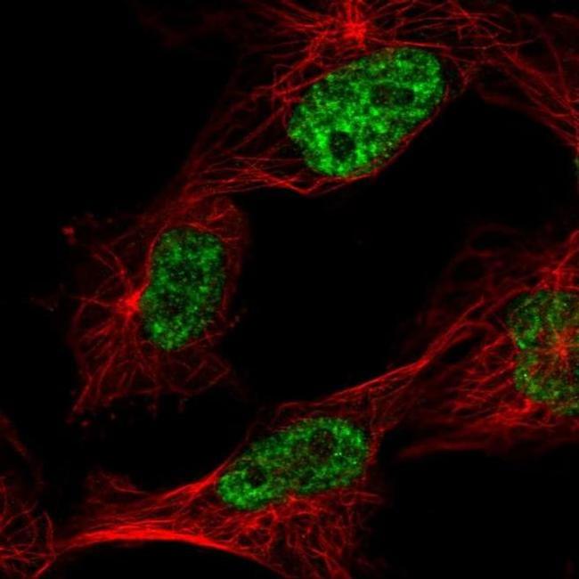 C1orf77 Antibody in Immunocytochemistry (ICC/IF)