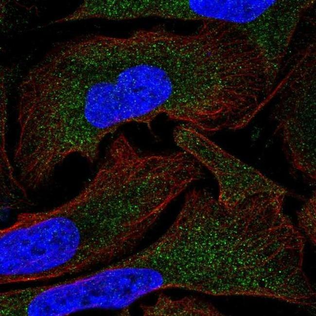 MOV10 Antibody in Immunocytochemistry (ICC/IF)