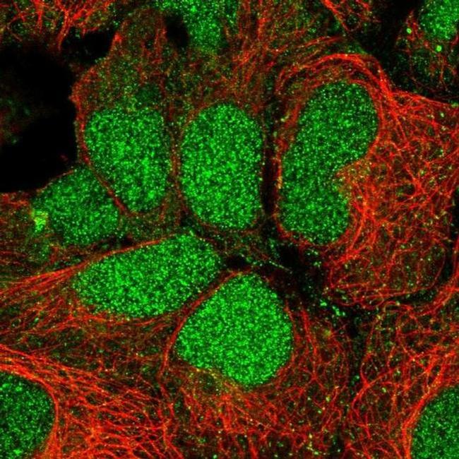 RFNG Antibody in Immunocytochemistry (ICC/IF)