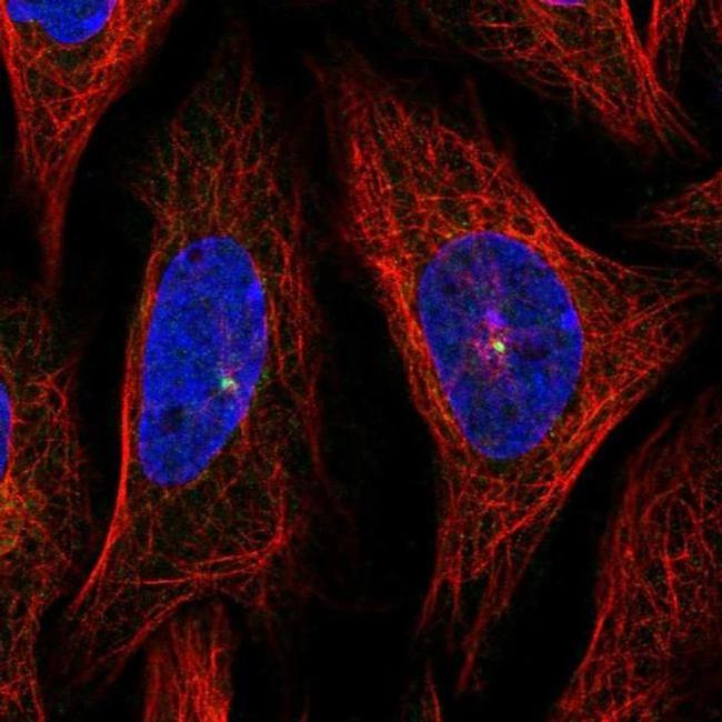 Jouberin Antibody in Immunocytochemistry (ICC/IF)