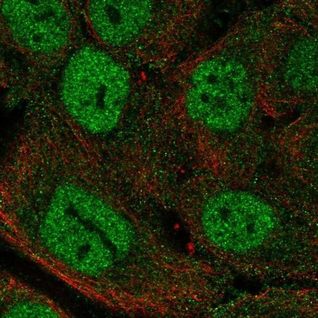 MTCP1 Antibody in Immunocytochemistry (ICC/IF)