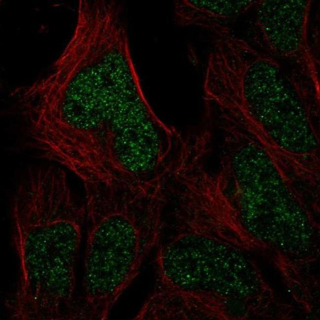 HUS1B Antibody in Immunocytochemistry (ICC/IF)