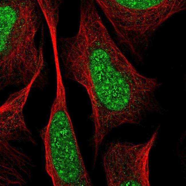 RREB1 Antibody in Immunocytochemistry (ICC/IF)