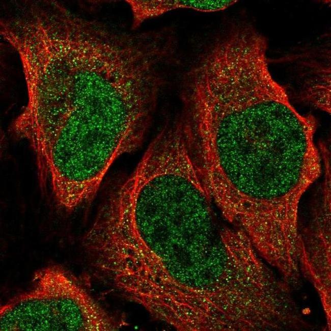 ATP6V1A Antibody in Immunocytochemistry (ICC/IF)