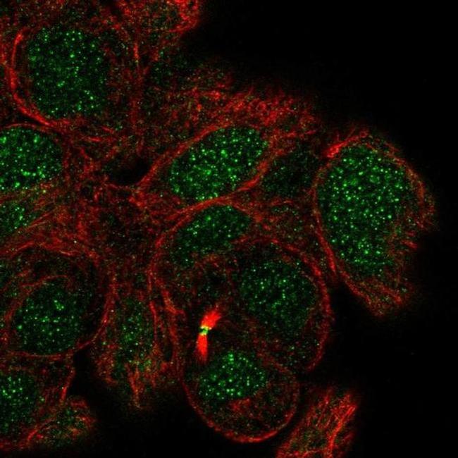 MBD5 Antibody in Immunocytochemistry (ICC/IF)