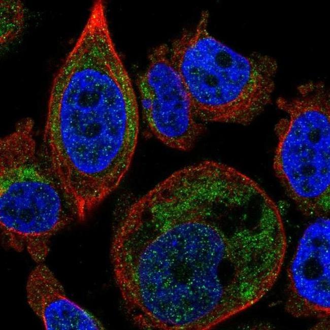 SLC25A16 Antibody in Immunocytochemistry (ICC/IF)