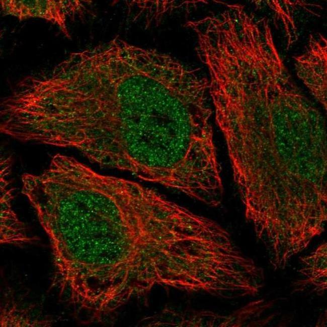 PDE8B Antibody in Immunocytochemistry (ICC/IF)