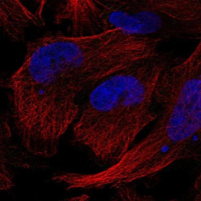 Gemin 5 Antibody in Immunocytochemistry (ICC/IF)