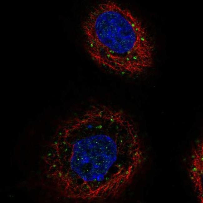 TGFBRAP1 Antibody in Immunocytochemistry (ICC/IF)