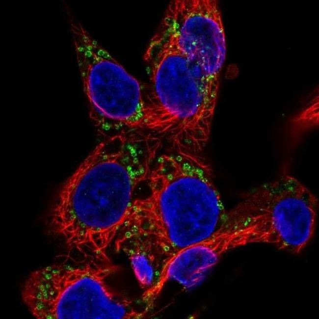 EDA Antibody in Immunocytochemistry (ICC/IF)