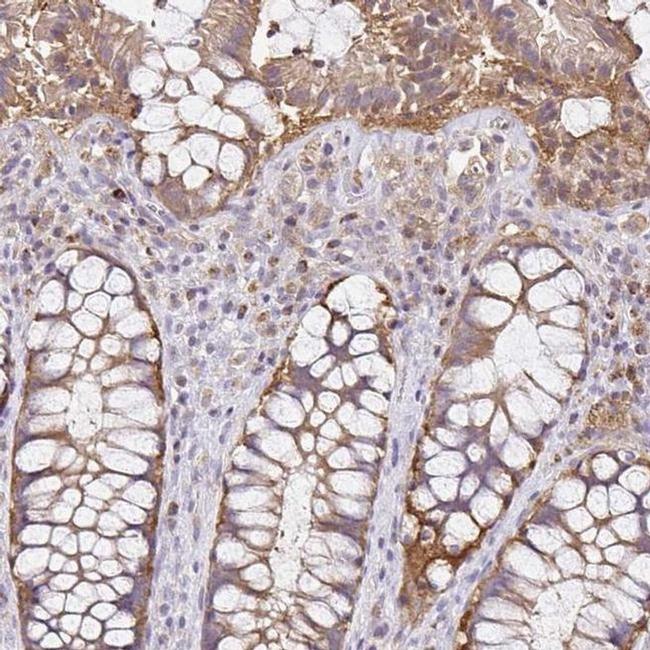 NADSYN1 Antibody in Immunohistochemistry (IHC)