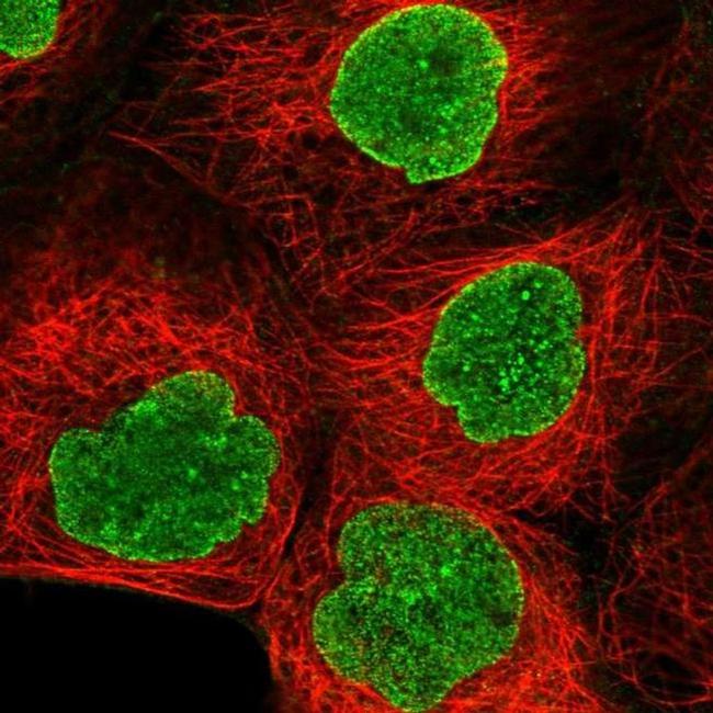 AMPD3 Antibody in Immunocytochemistry (ICC/IF)