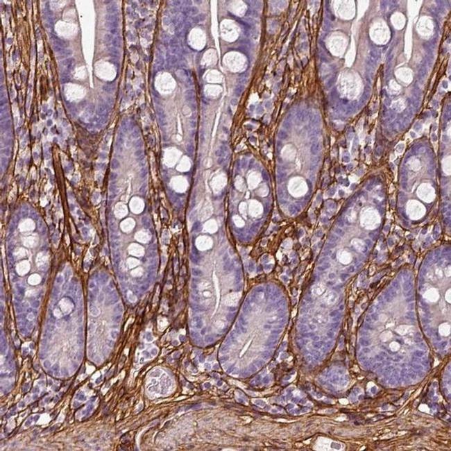 COL6A2 Antibody in Immunohistochemistry (IHC)