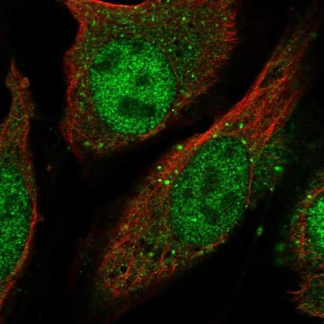 LGSN Antibody in Immunocytochemistry (ICC/IF)