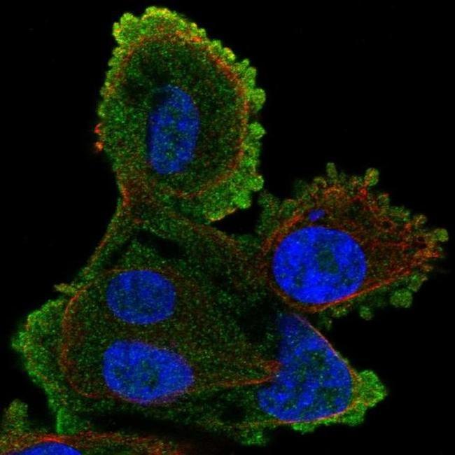 ATP8A2 Antibody in Immunocytochemistry (ICC/IF)