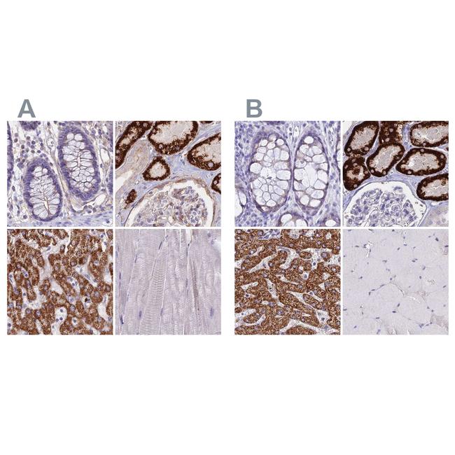 GLYAT Antibody in Immunohistochemistry (IHC)