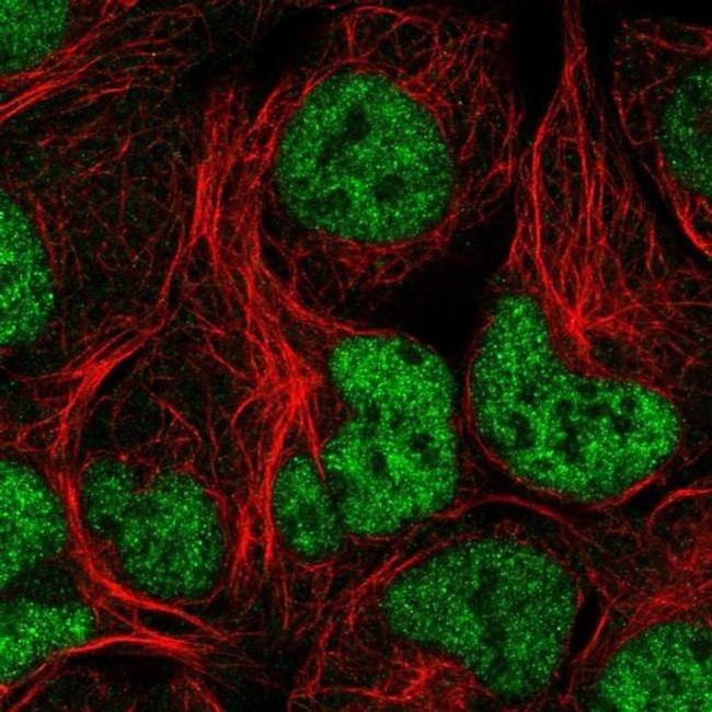 NCAPD3 Antibody in Immunocytochemistry (ICC/IF)