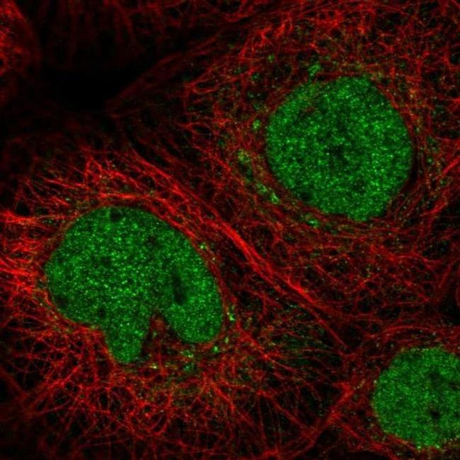 C11orf63 Antibody in Immunocytochemistry (ICC/IF)