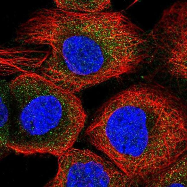 ACOT11 Antibody in Immunocytochemistry (ICC/IF)