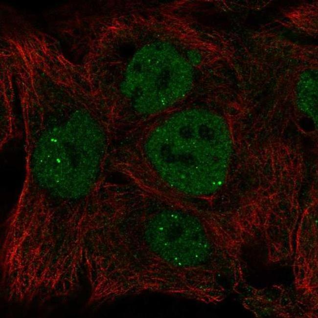 INO80 Antibody in Immunocytochemistry (ICC/IF)