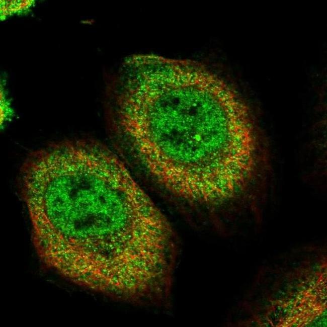 PEPP2 Antibody in Immunocytochemistry (ICC/IF)