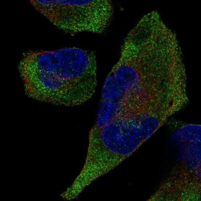 TRIM9 Antibody in Immunocytochemistry (ICC/IF)